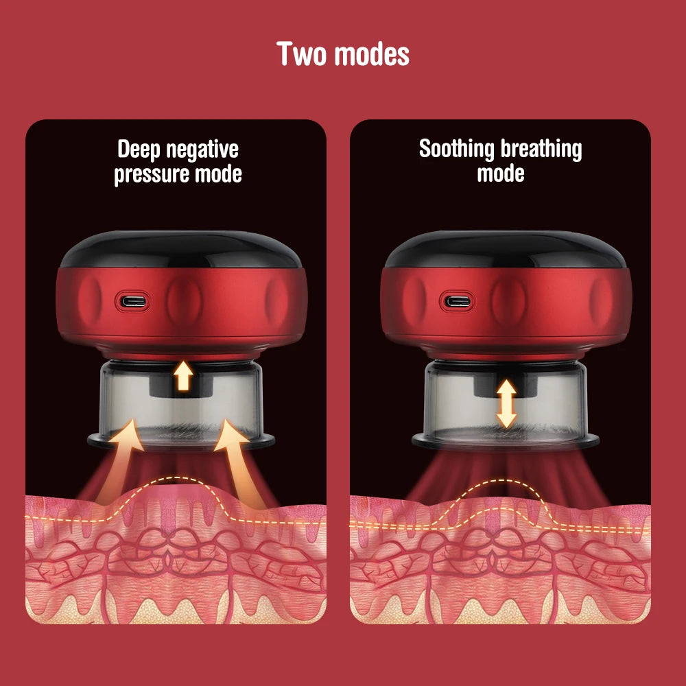 Smart 3-in-1 Vacuum Cupping & Gua Sha Set | 12-Level Heat & Suction Recovery System