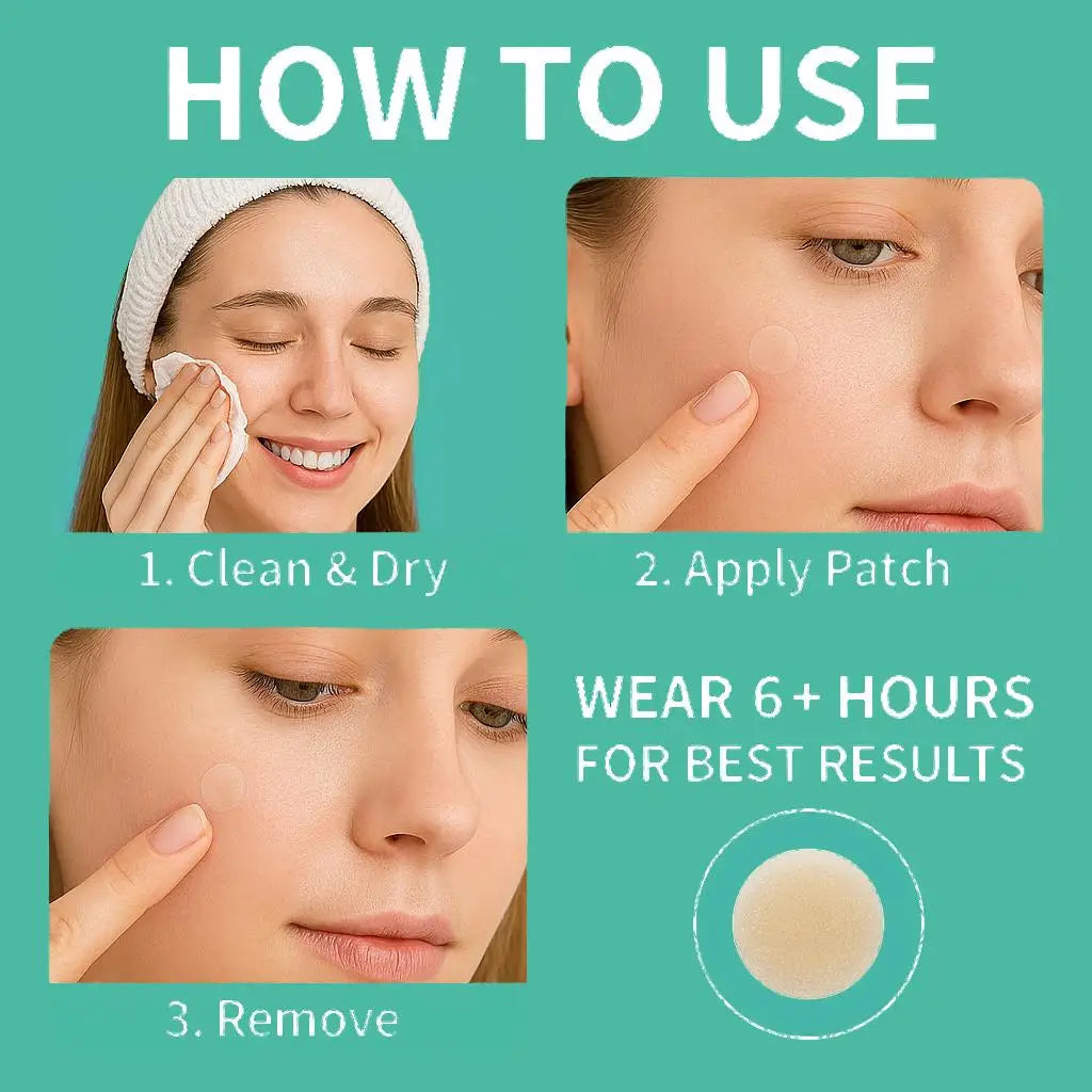 443pcs water-based gel acne patch - removes facial acne, soothes and heals the skin, multiple sizes of oversized acne patches